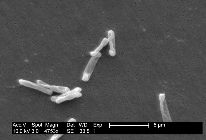 Clostridium-difficile